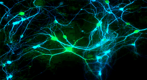 Colloque : Neurosciences, en quoi vont-elles modifier notre vie ?